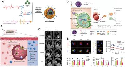 Nanomaterials-Mediated Therapeutics and Diagnosis Strategies for Myocardial Infarction